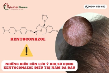 Những điều cần lưu ý khi sử dụng Kentoconazol điều trị nấm da đầu